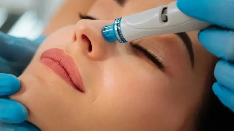 rejuvenecimiento facial